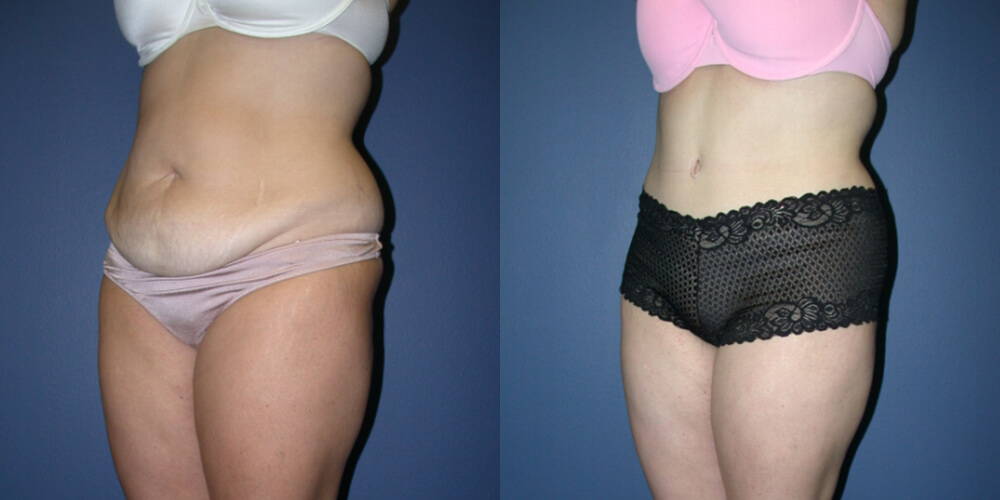 Before and After Image