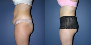 Before and After Image