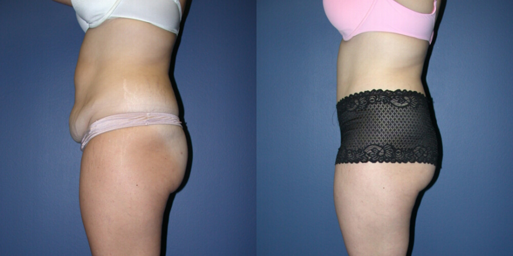 Before and After Image