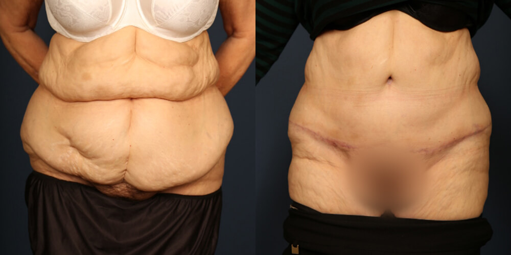 Before and After Image