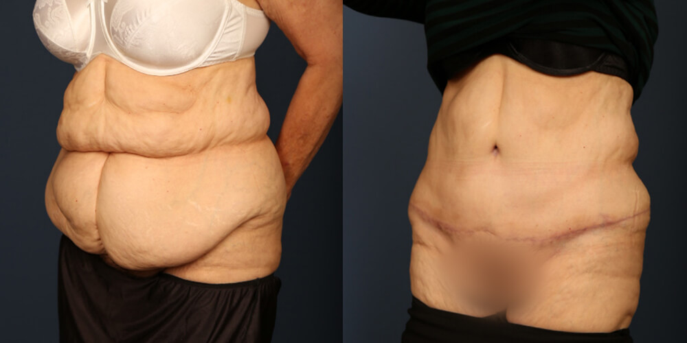 Before and After Image